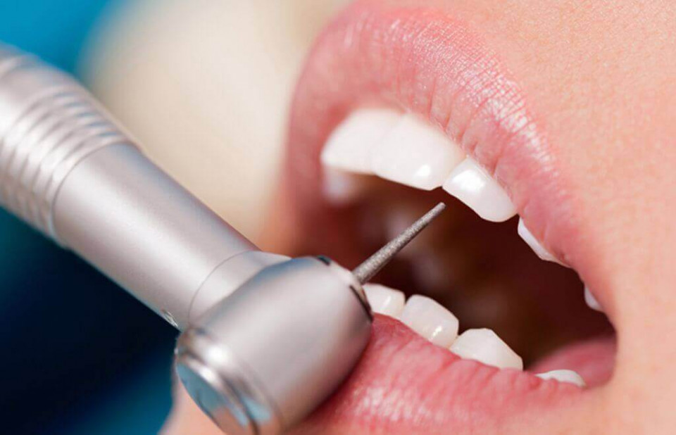 Терапия в стоматологии – основные направления специализации